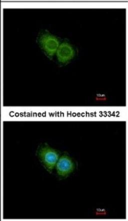 Immunocytochemistry/Immunofluorescence: CXCR1 Antibody [NBP2-16043] - Immunofluorescence analysis of methanol-fixed Hep G2, using antibody at 1:500 dilution.