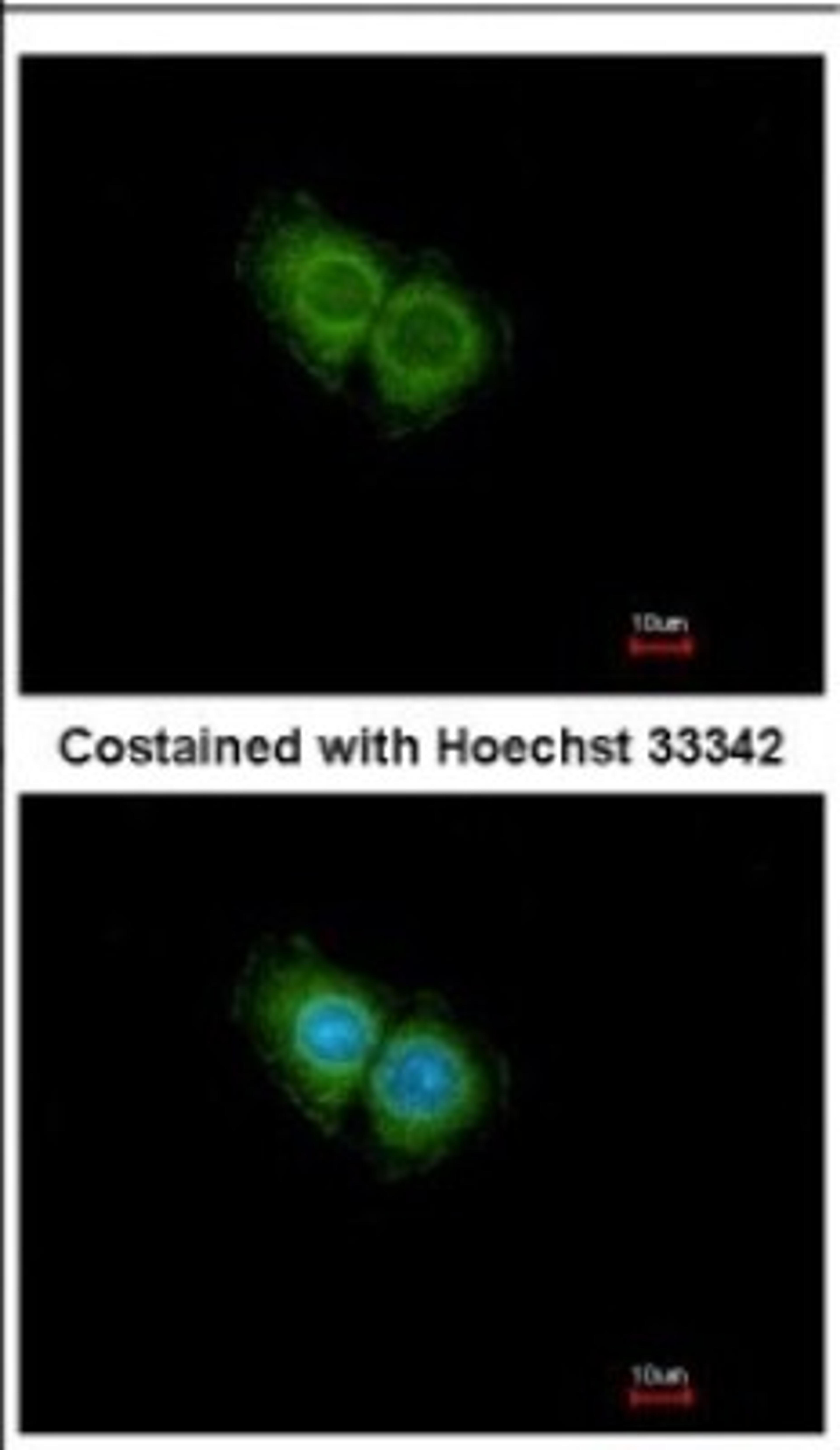 Immunocytochemistry/Immunofluorescence: CXCR1 Antibody [NBP2-16043] - Immunofluorescence analysis of methanol-fixed Hep G2, using antibody at 1:500 dilution.