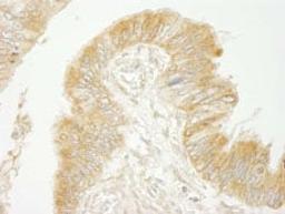 Detection of human BIG2/ARFGEF2 by immunohistochemistry.