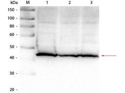 Western blot analysis of Hela lysate (Lane1), HEK293 lysate (Lane2), Jurkat lysate (Lane3) using Aldolase antibody