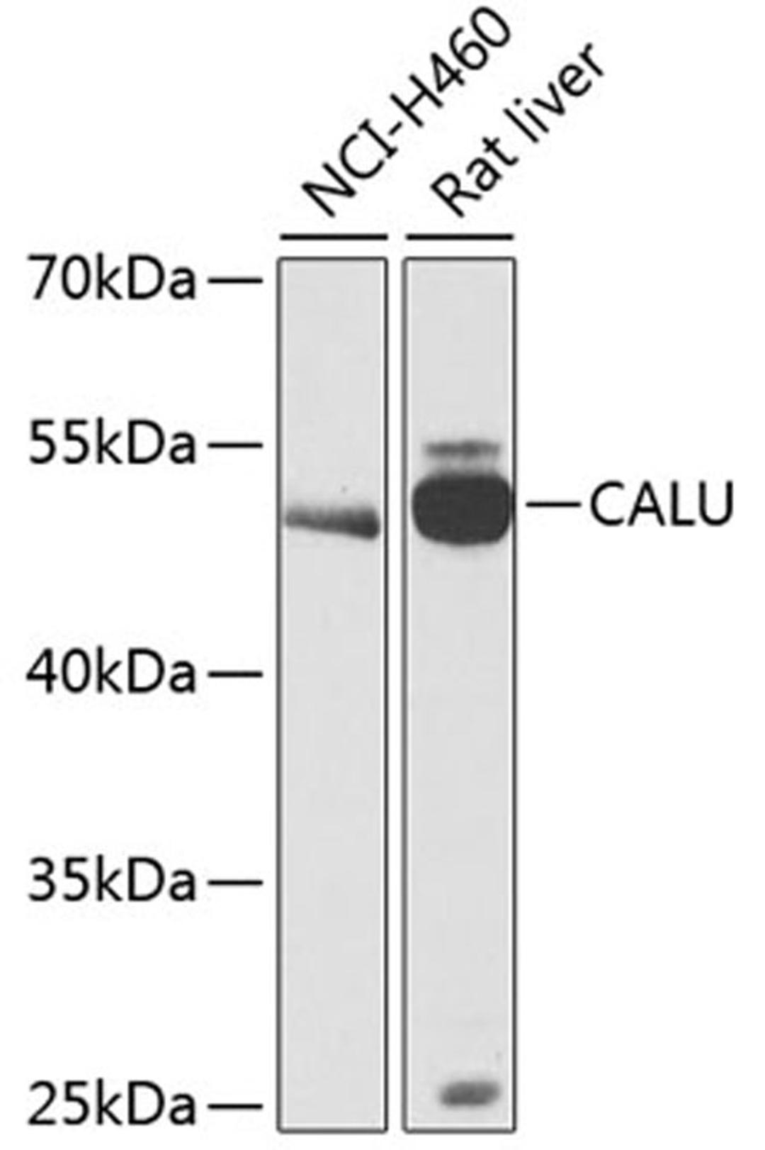 Western blot - CALU antibody (A12408)