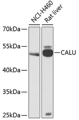 Western blot - CALU antibody (A12408)