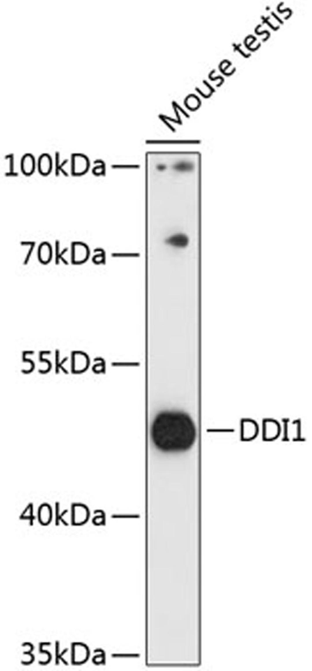 Western blot - DDI1 antibody (A14468)