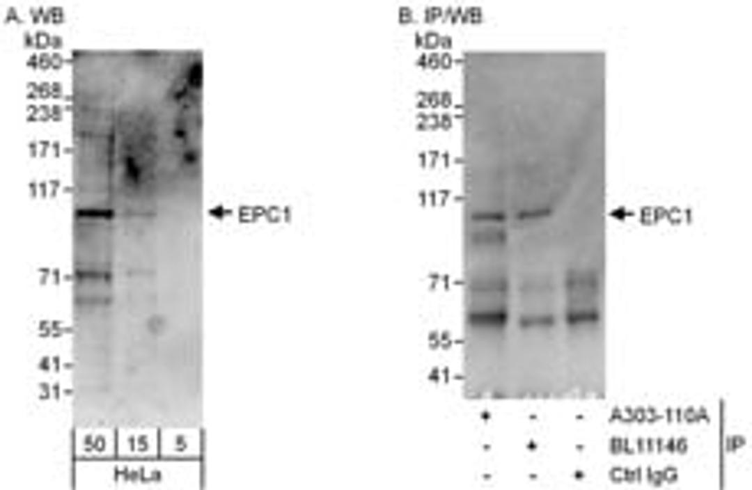 Detection of human EPC1 by western blot and immunoprecipitation.