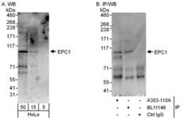 Detection of human EPC1 by western blot and immunoprecipitation.