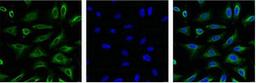 IF analysis of Hela with antibody (Left) and DAPI (Right) diluted at 1:100.