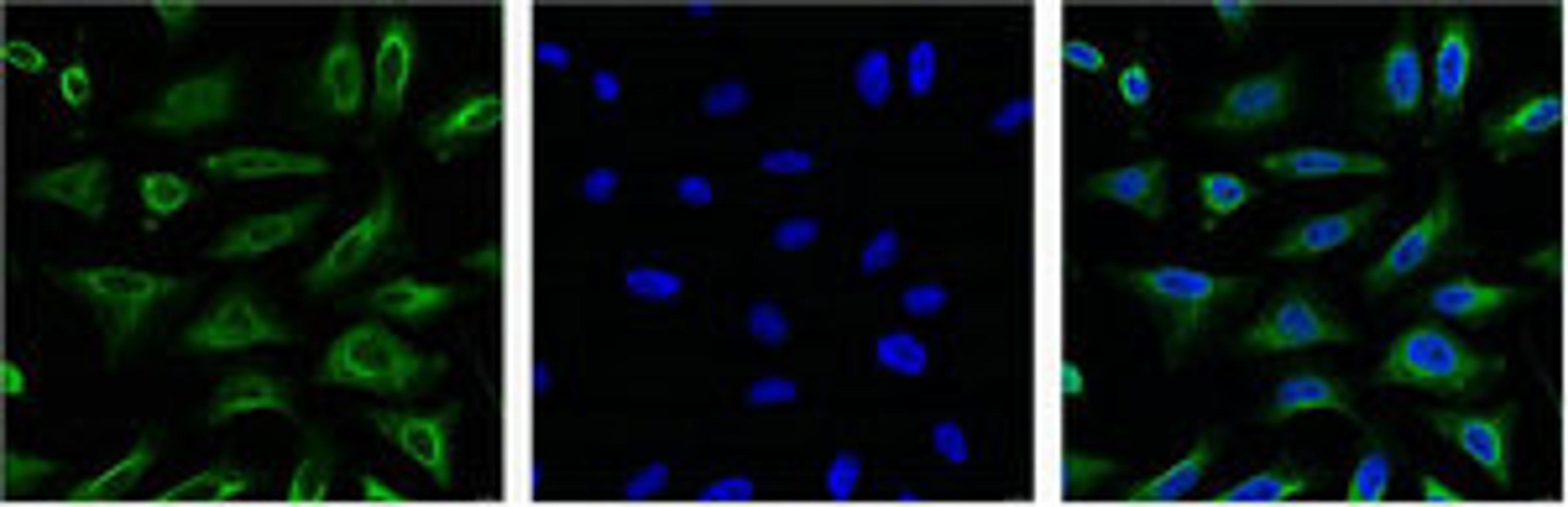 IF analysis of Hela with antibody (Left) and DAPI (Right) diluted at 1:100.