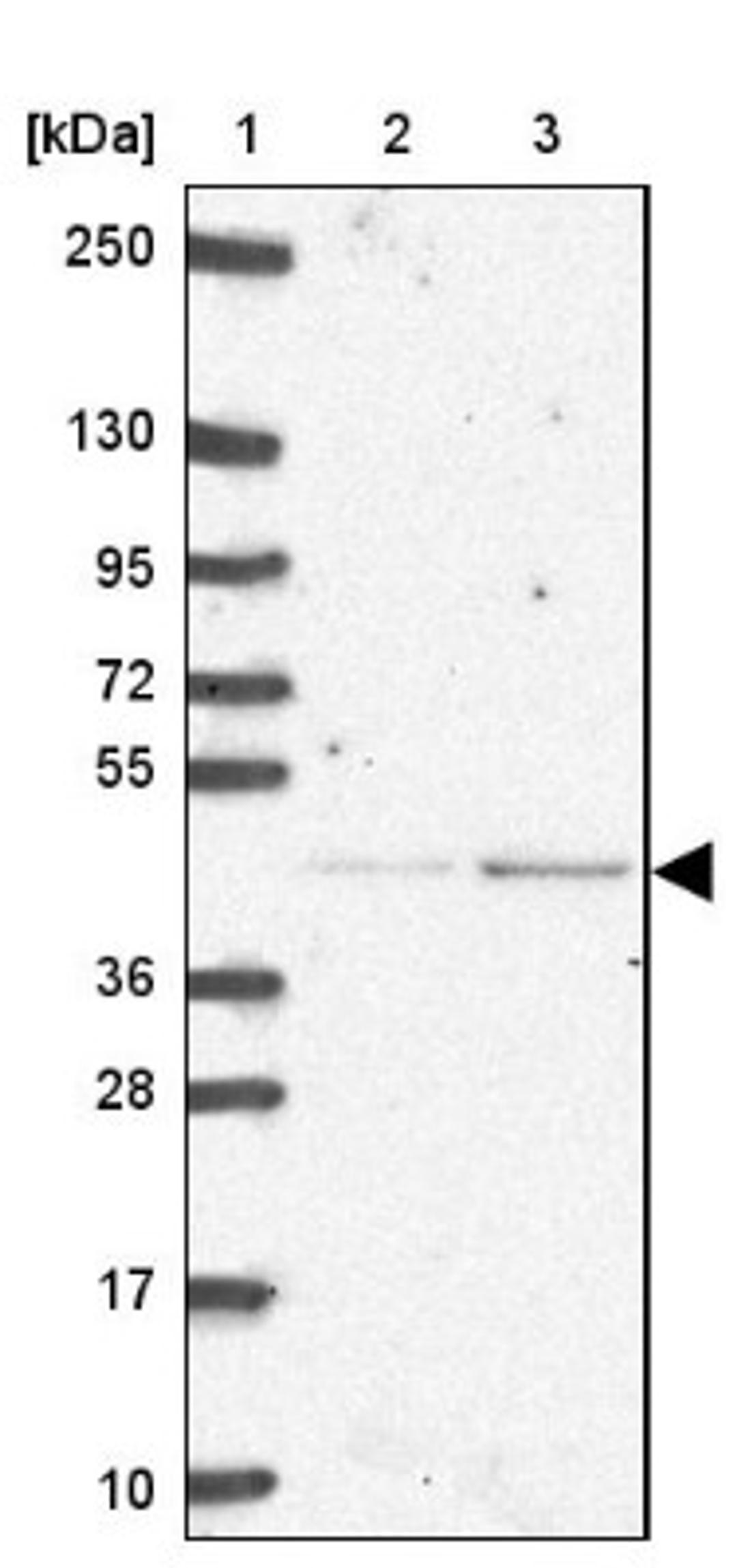 Western Blot: IP6K3 Antibody [NBP2-33689] - Lane 1: Marker [kDa] 250, 130, 95, 72, 55, 36, 28, 17, 10<br/>Lane 2: Human cell line RT-4<br/>Lane 3: Human cell line U-251MG sp