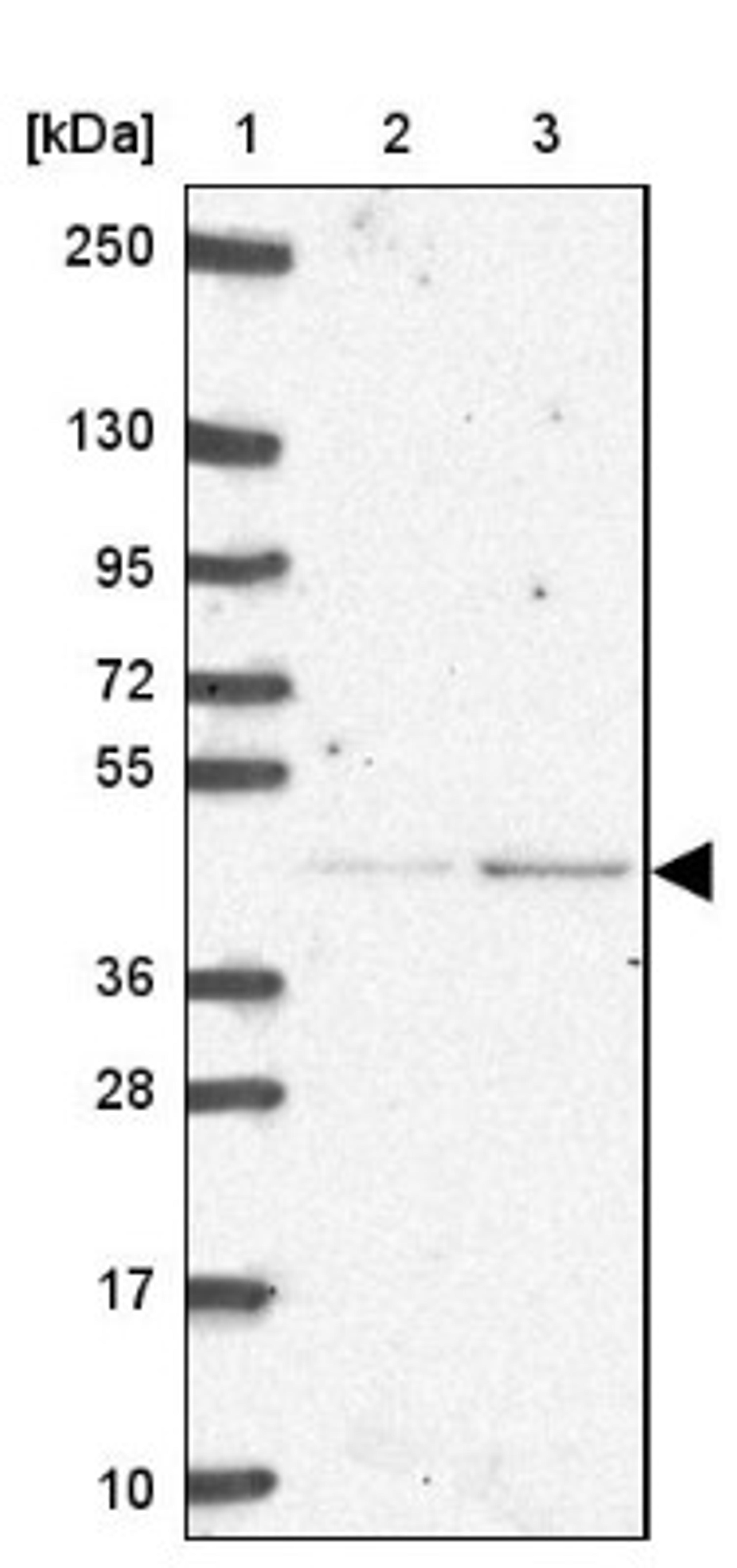 Western Blot: IP6K3 Antibody [NBP2-33689] - Lane 1: Marker [kDa] 250, 130, 95, 72, 55, 36, 28, 17, 10<br/>Lane 2: Human cell line RT-4<br/>Lane 3: Human cell line U-251MG sp