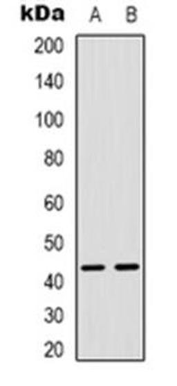 Western blot analysis of MAPKAPK3 expression in Hela (Lane 1), Jurkat (Lane 2) whole cell lysates using MAPKAPK3 antibody