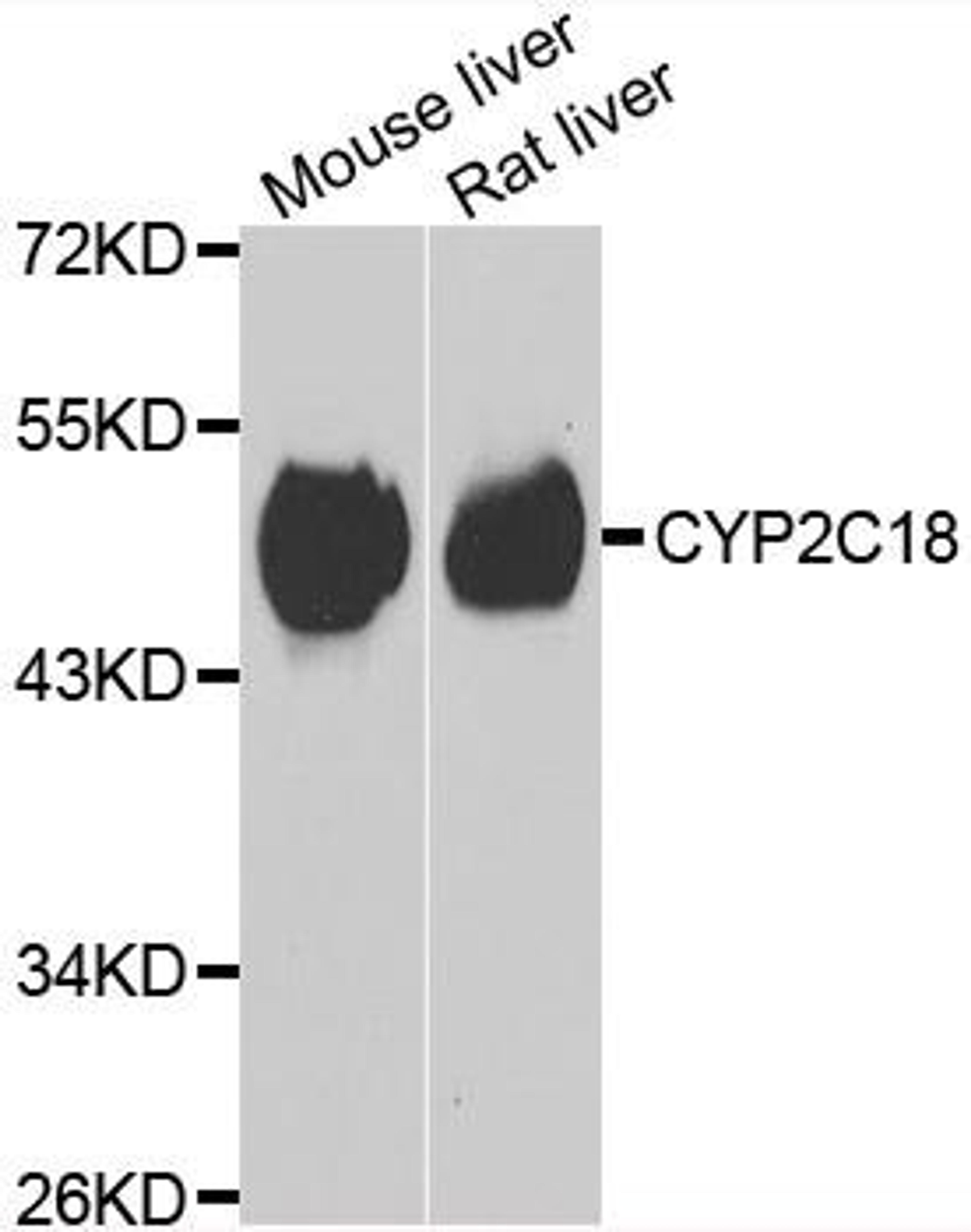 Western blot analysis of extracts of various cell lines using CYP2C18 antibody