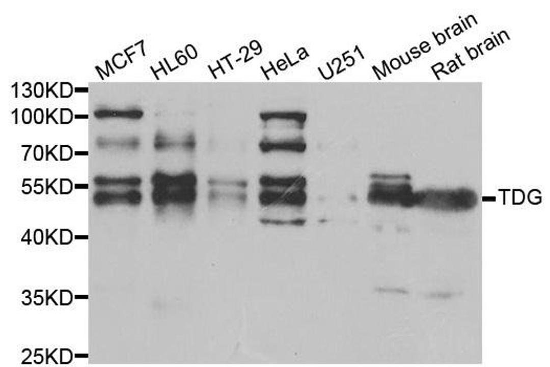 Western blot analysis of extracts of various cell lines using TDG antibody