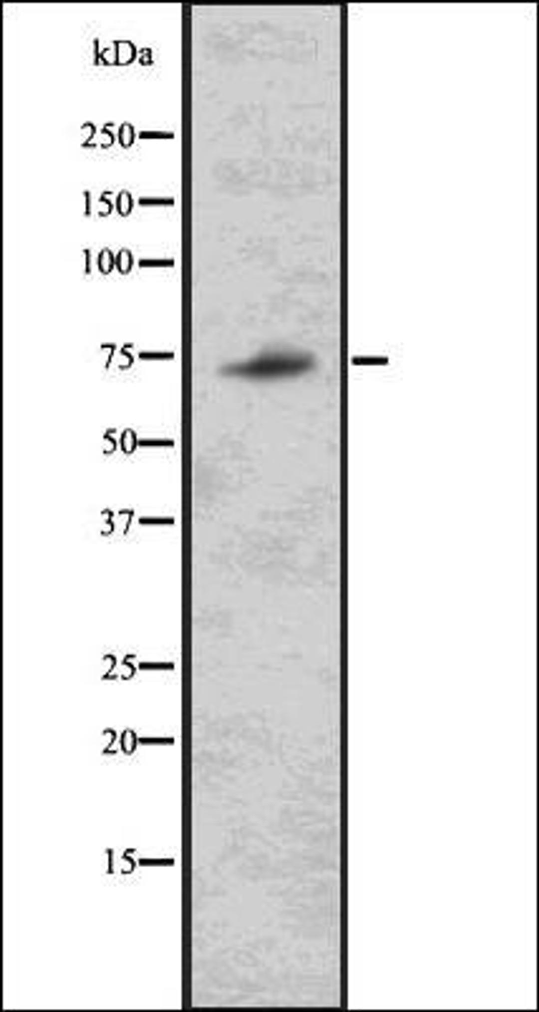 Western blot analysis of 293 whole cell lysates using TRIM32 antibody