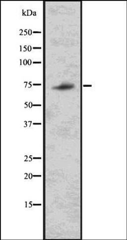 Western blot analysis of 293 whole cell lysates using TRIM32 antibody