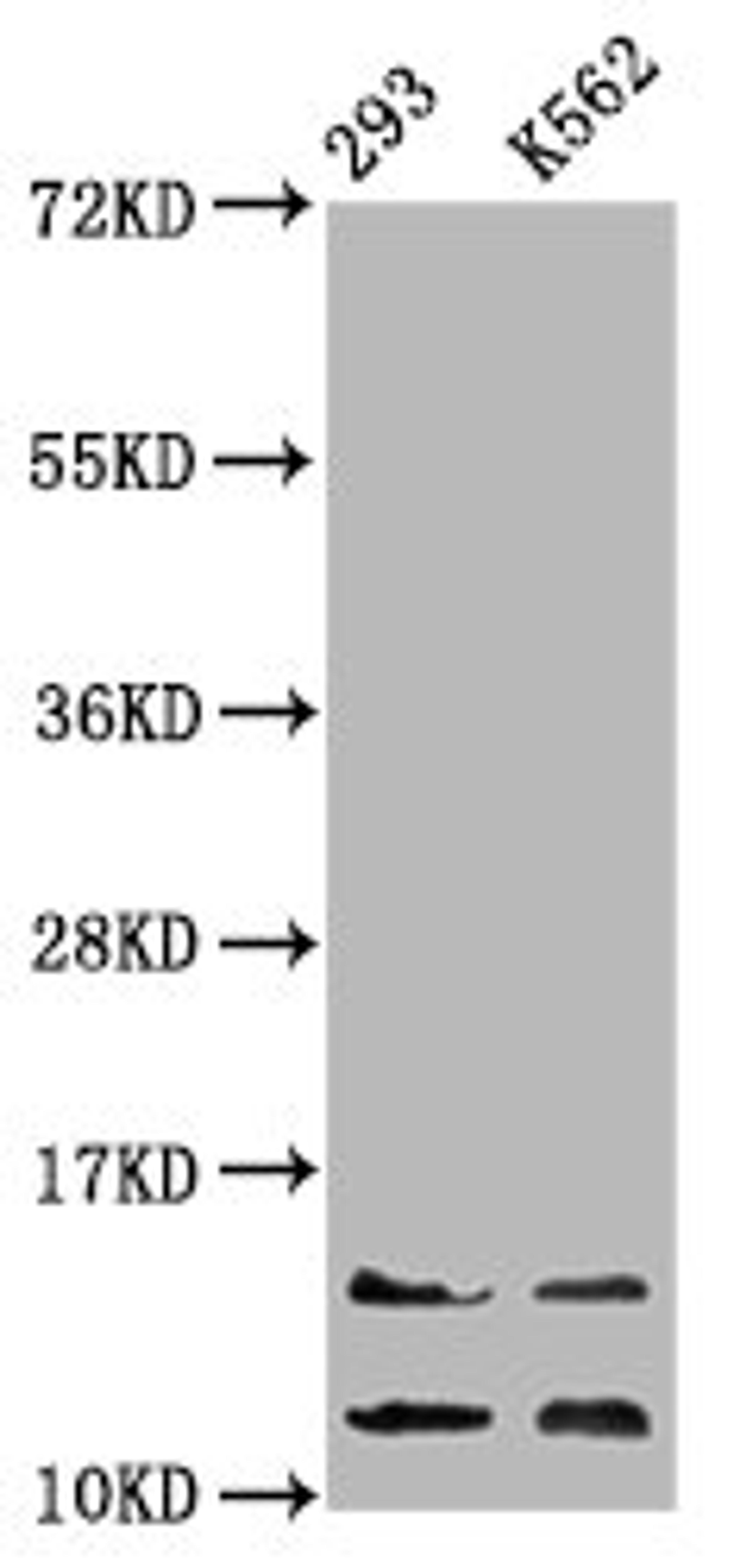 Western Blot. Positive WB detected in: 293 whole cell lysate, K562 whole cell lysate. All lanes: HIST1H4A antibody at 0.86µg/ml. Secondary. Goat polyclonal to rabbit IgG at 1/50000 dilution. Predicted band size: 12 kDa. Observed band size: 12, 14 kDa
