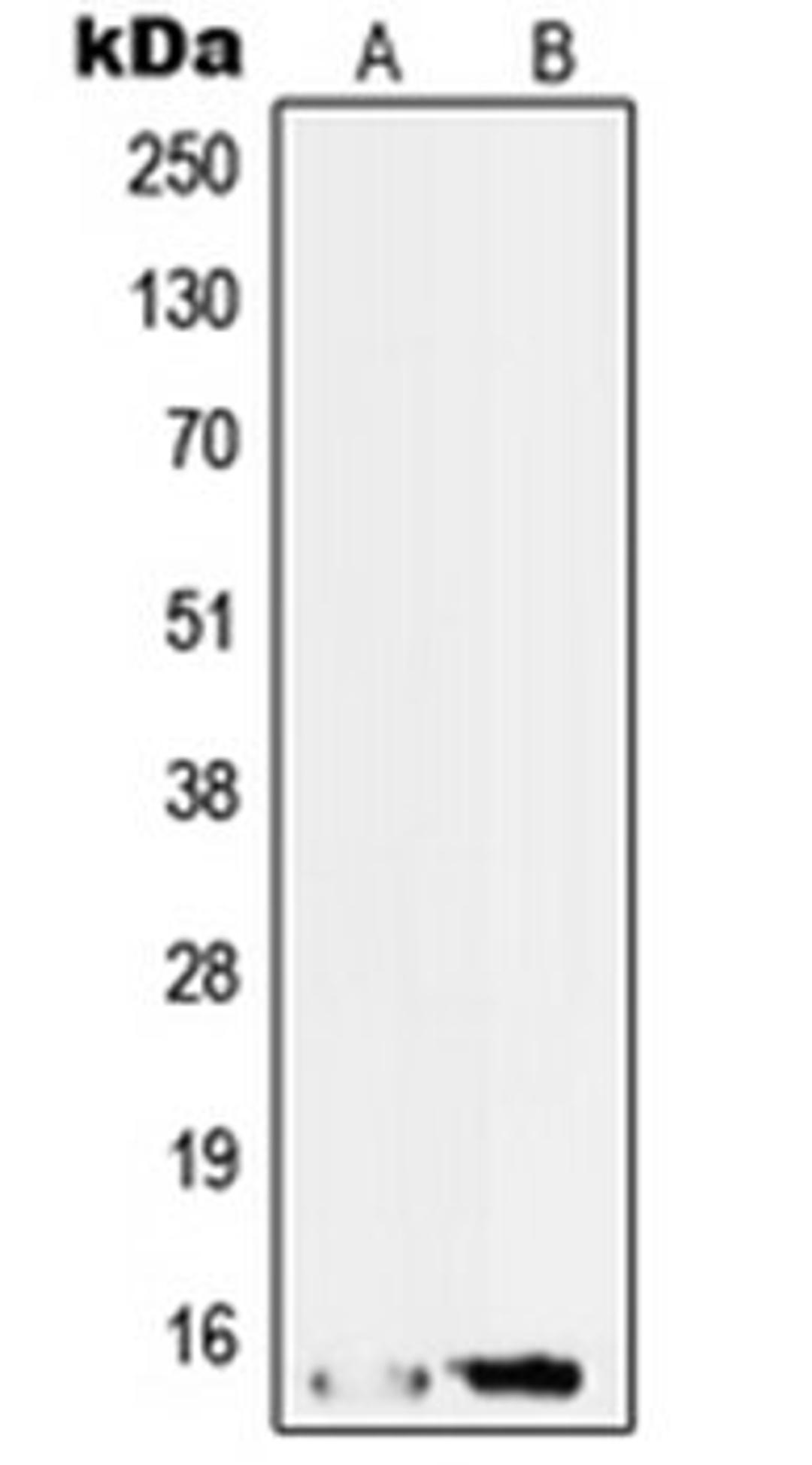 Western blot analysis of HepG2 (Lane 1), RT4 (Lane 2) whole cell lysates using SF3B14 antibody