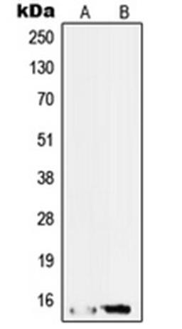 Western blot analysis of HepG2 (Lane 1), RT4 (Lane 2) whole cell lysates using SF3B14 antibody