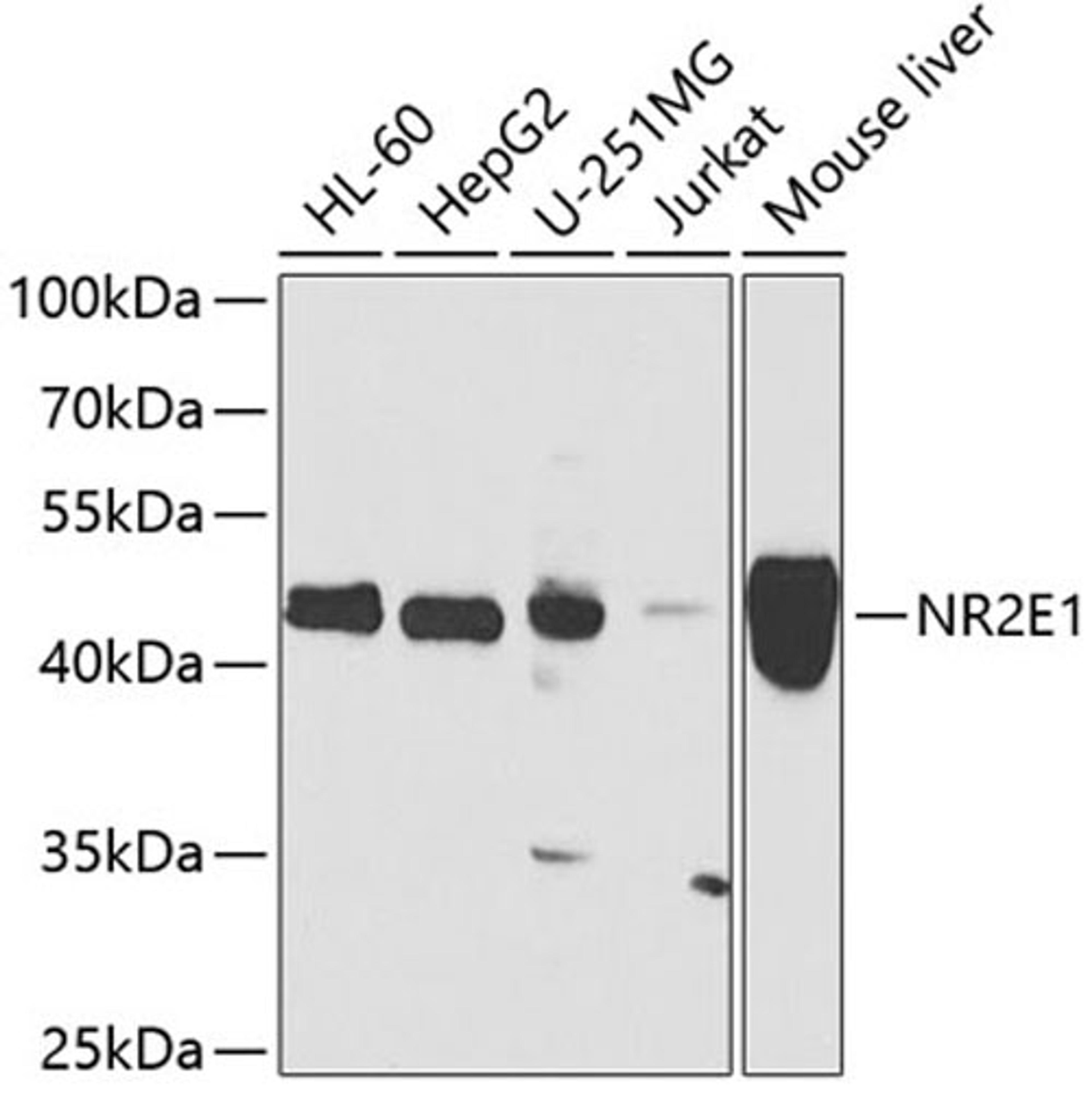 Western blot - NR2E1 antibody (A7455)