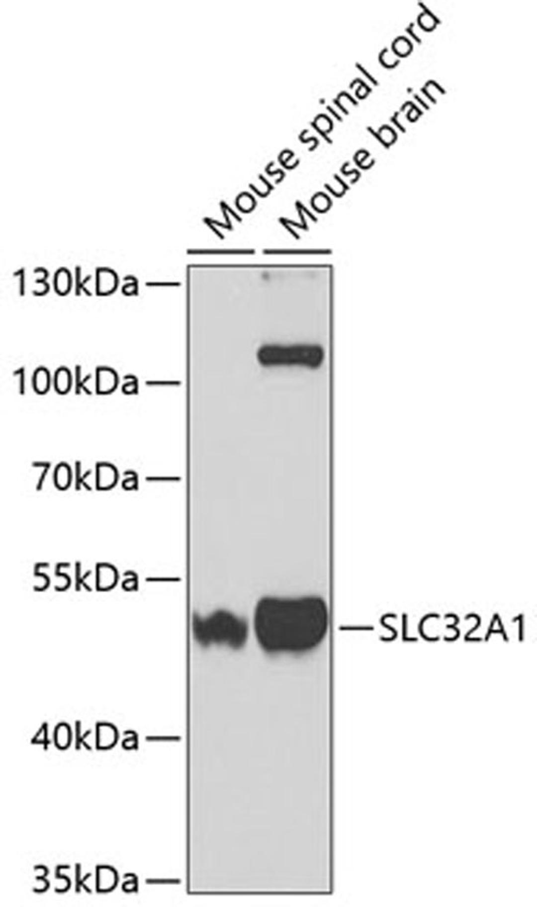 Western blot - SLC32A1 antibody (A3129)