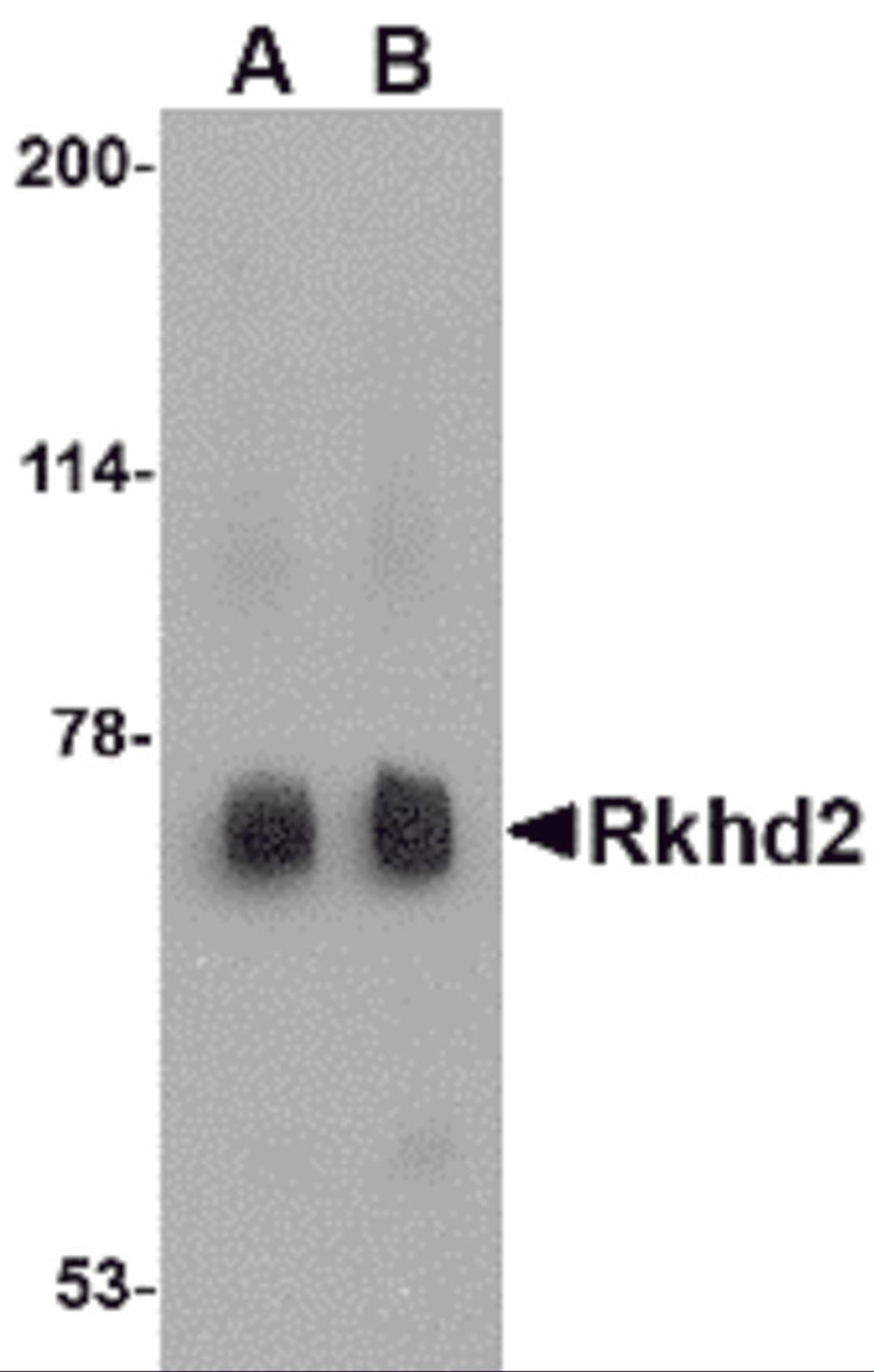 Western blot analysis of Rkhd2 in rat heart tissue lysate with Rkhd2 antibody at (A) 0.5 μg/mL and (B) 1 μg/mL.