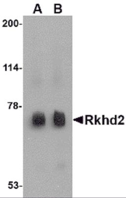 Western blot analysis of Rkhd2 in rat heart tissue lysate with Rkhd2 antibody at (A) 0.5 μg/mL and (B) 1 μg/mL.