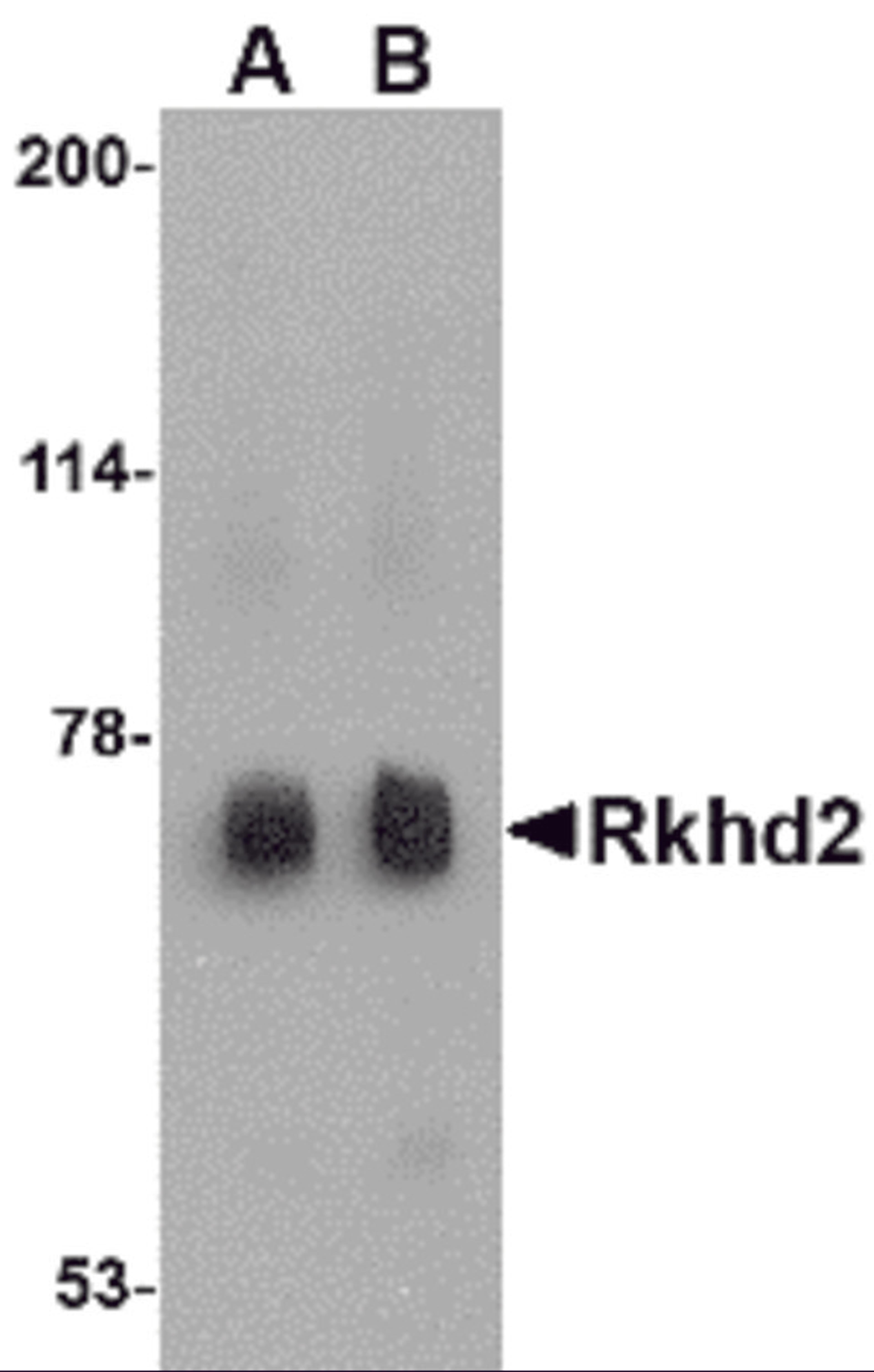 Western blot analysis of Rkhd2 in rat heart tissue lysate with Rkhd2 antibody at (A) 0.5 μg/mL and (B) 1 μg/mL.
