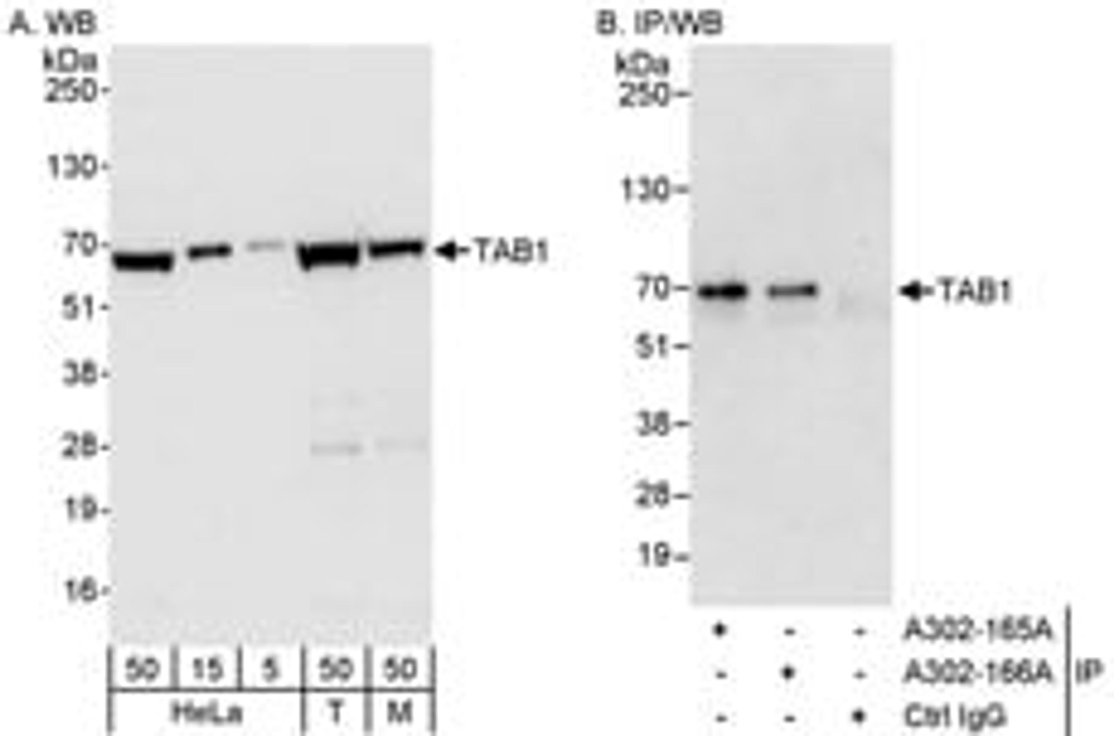 Detection of human and mouse TAB1 by western blot (h&m) and immunoprecipitation (h).