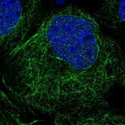 Immunocytochemistry/Immunofluorescence: TXNDC3 Antibody [NBP1-85616] - Staining of human cell line A-431 shows positivity in cytoskeleton (microtubules).