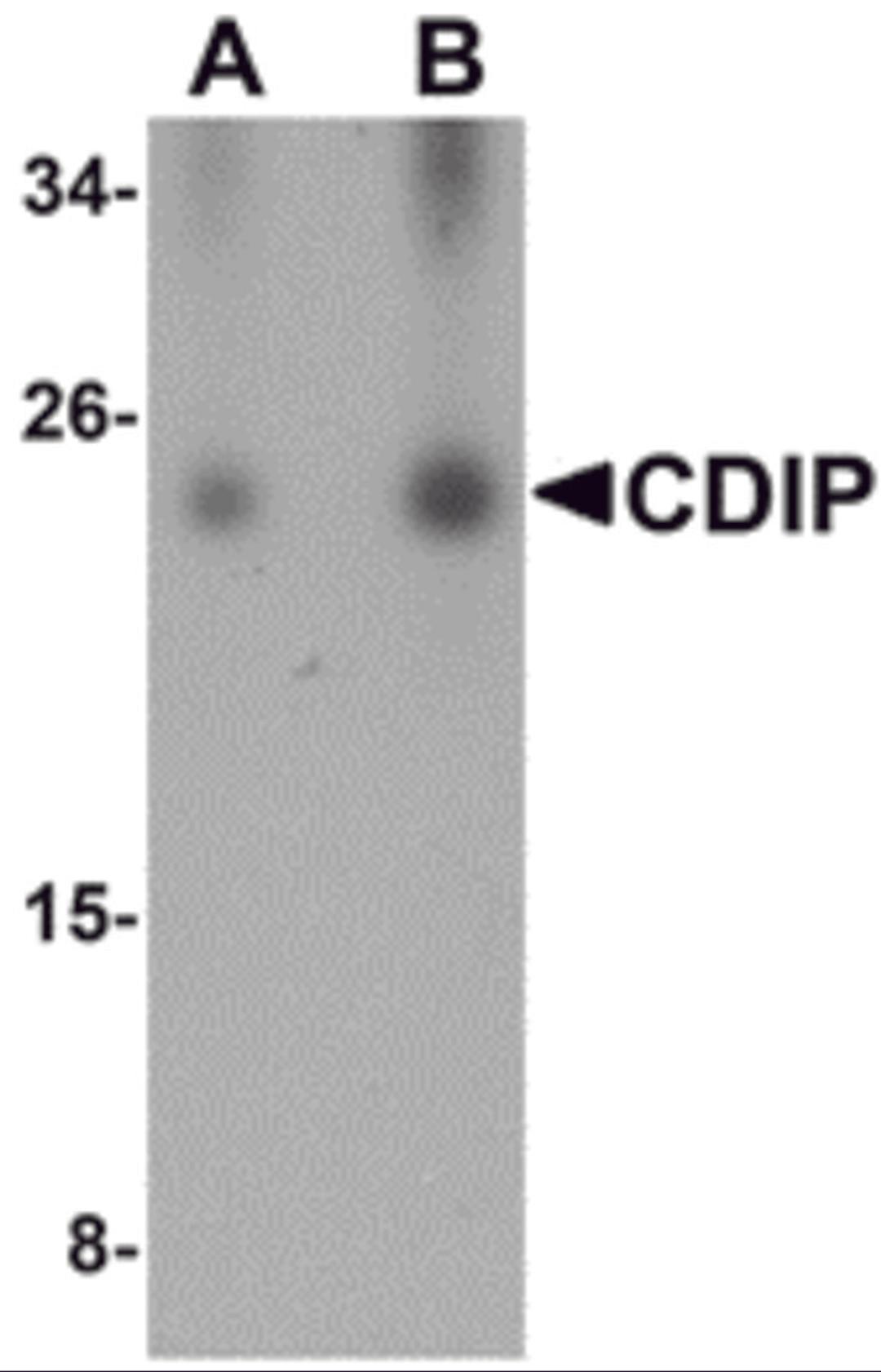 Western blot analysis of CDIP in human brain lysate with CDIP antibody at (A) 0.25 and (B) 0.5 μg/mL.