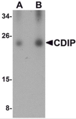 Western blot analysis of CDIP in human brain lysate with CDIP antibody at (A) 0.25 and (B) 0.5 μg/mL.