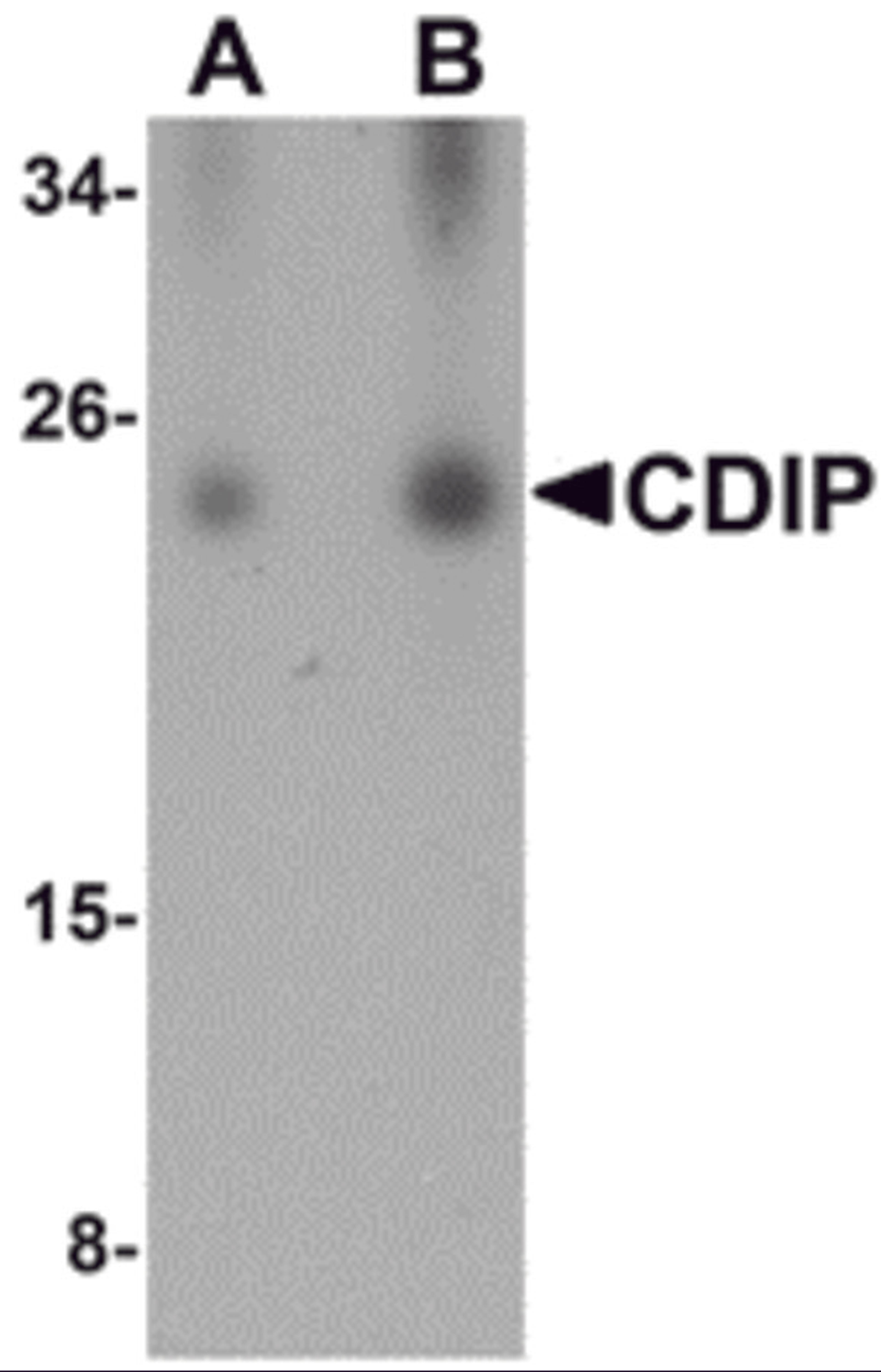 Western blot analysis of CDIP in human brain lysate with CDIP antibody at (A) 0.25 and (B) 0.5 μg/mL.