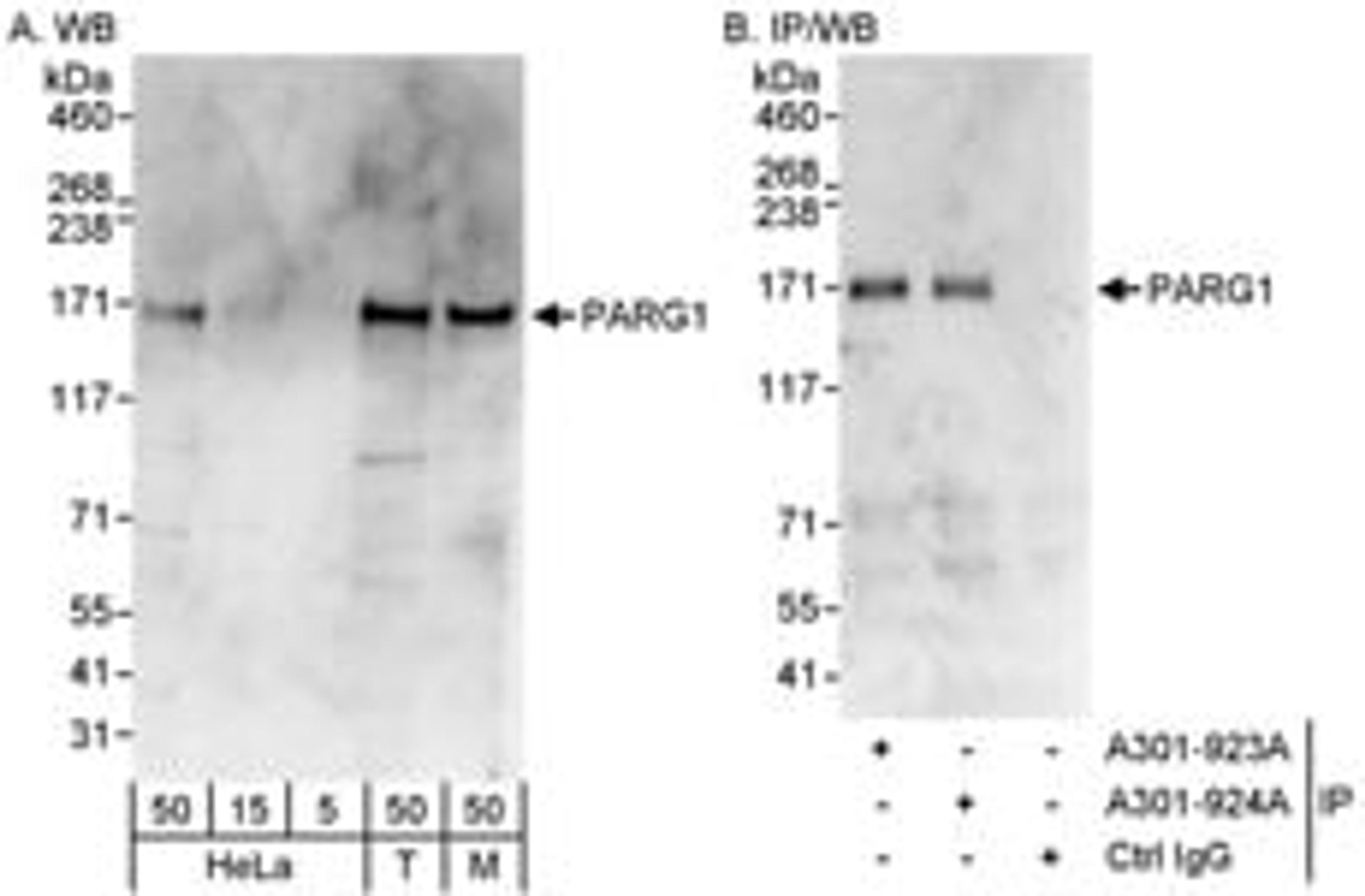 Detection of human and mouse PARG1 by western blot (h&m) and immunoprecipitation (h).