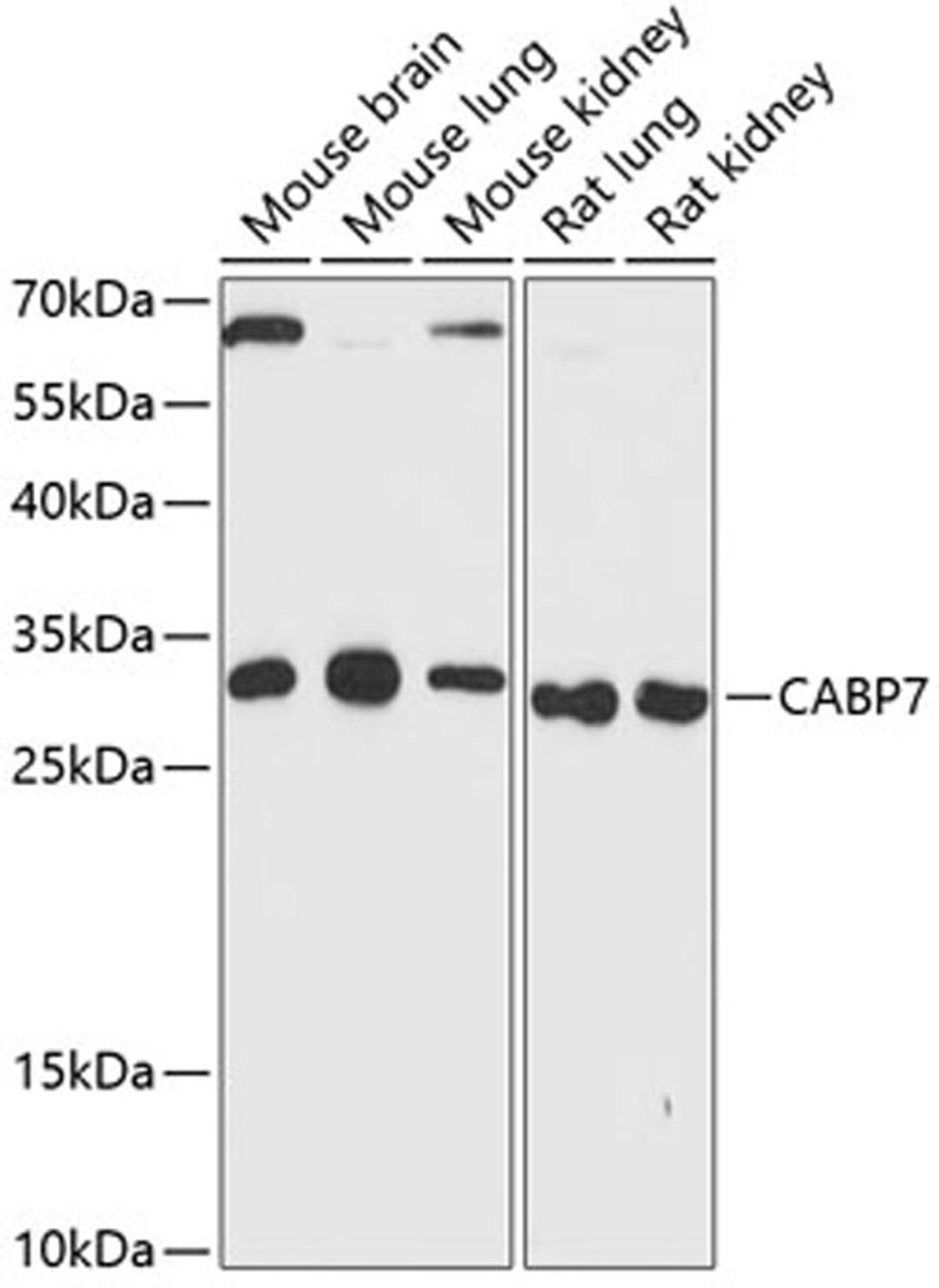 Western blot - CABP7 antibody (A13703)