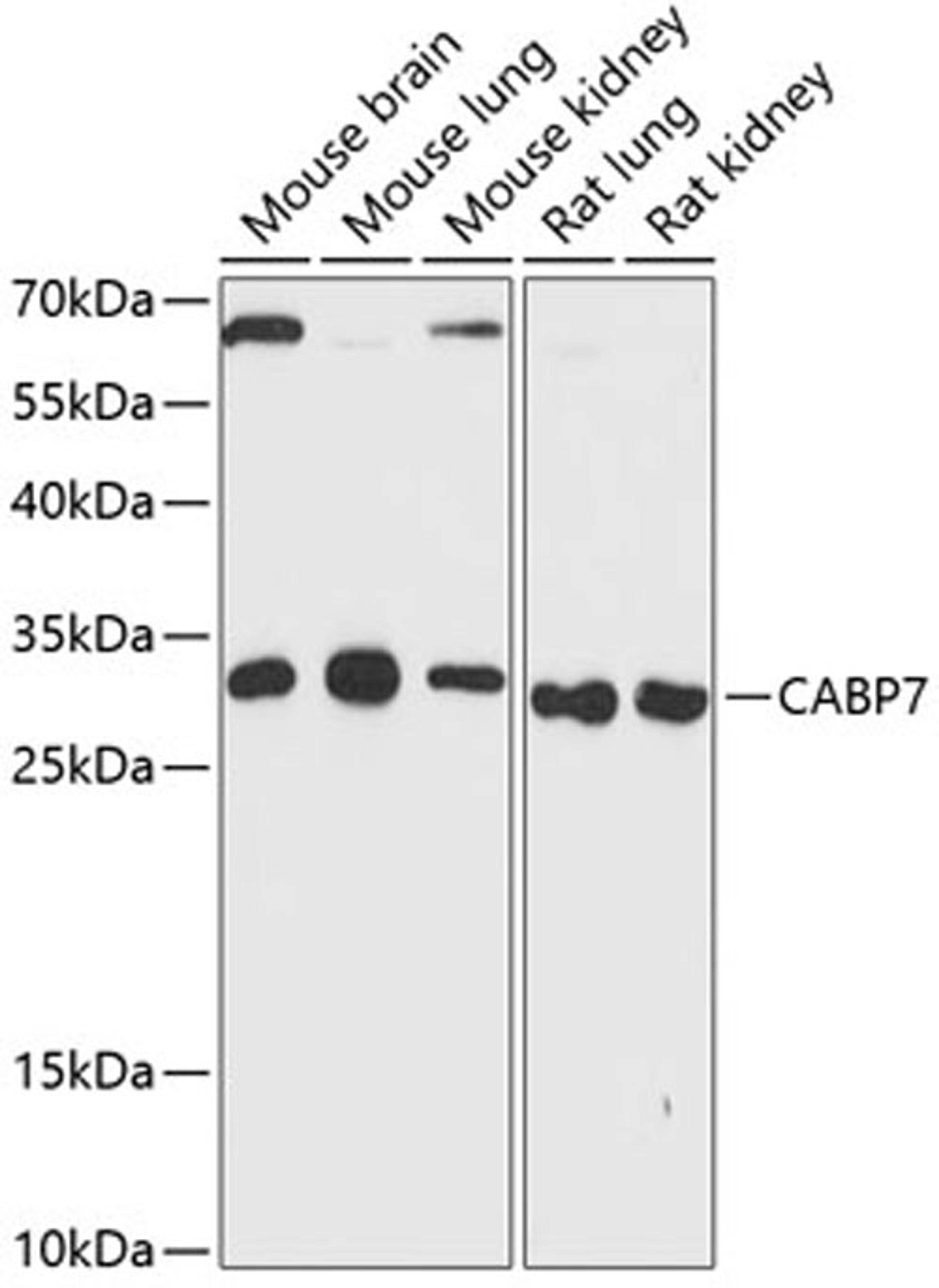 Western blot - CABP7 antibody (A13703)