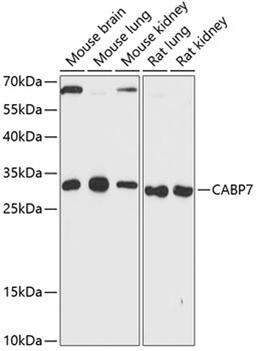 Western blot - CABP7 antibody (A13703)