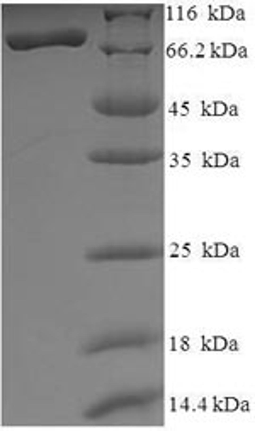 (Tris-Glycine gel) Discontinuous SDS-PAGE (reduced) with 5% enrichment gel and 15% separation gel.