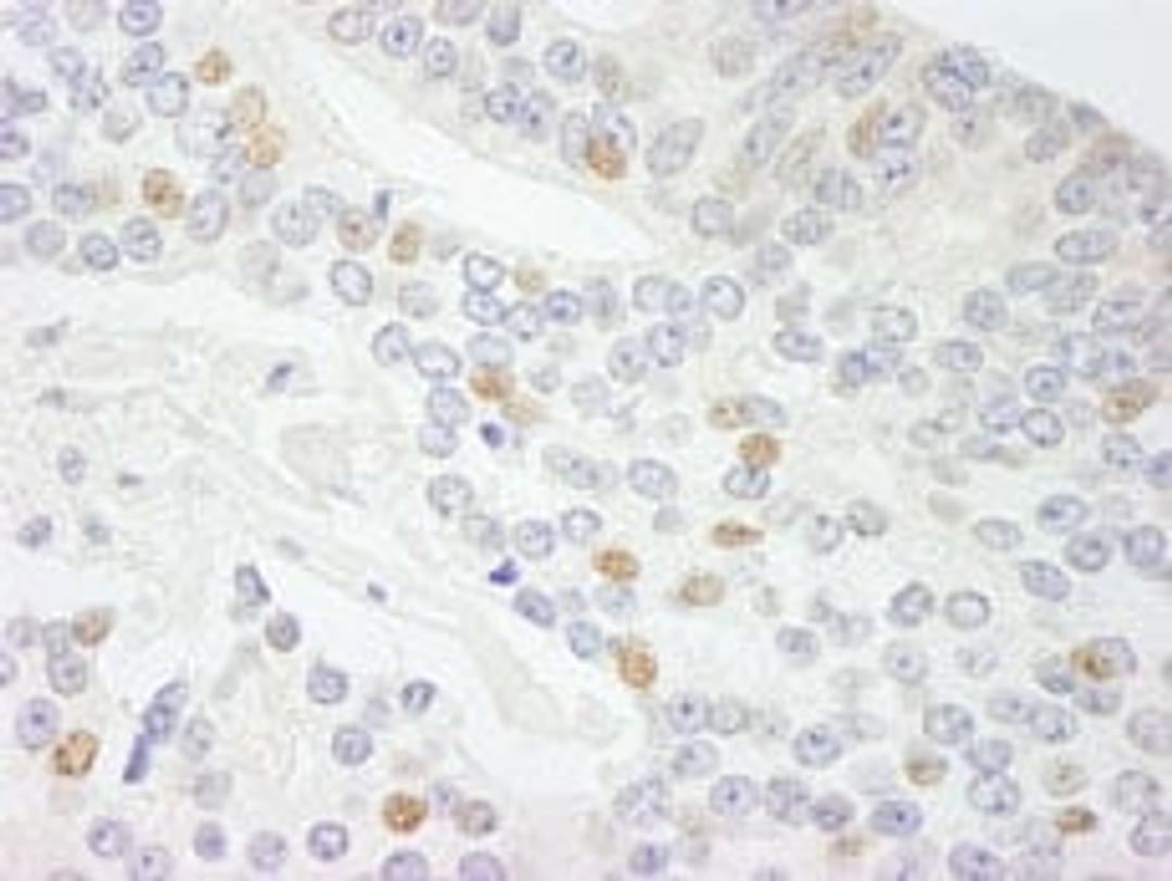 Detection of human NCOA5 (CIA) by immunohistochemistry.