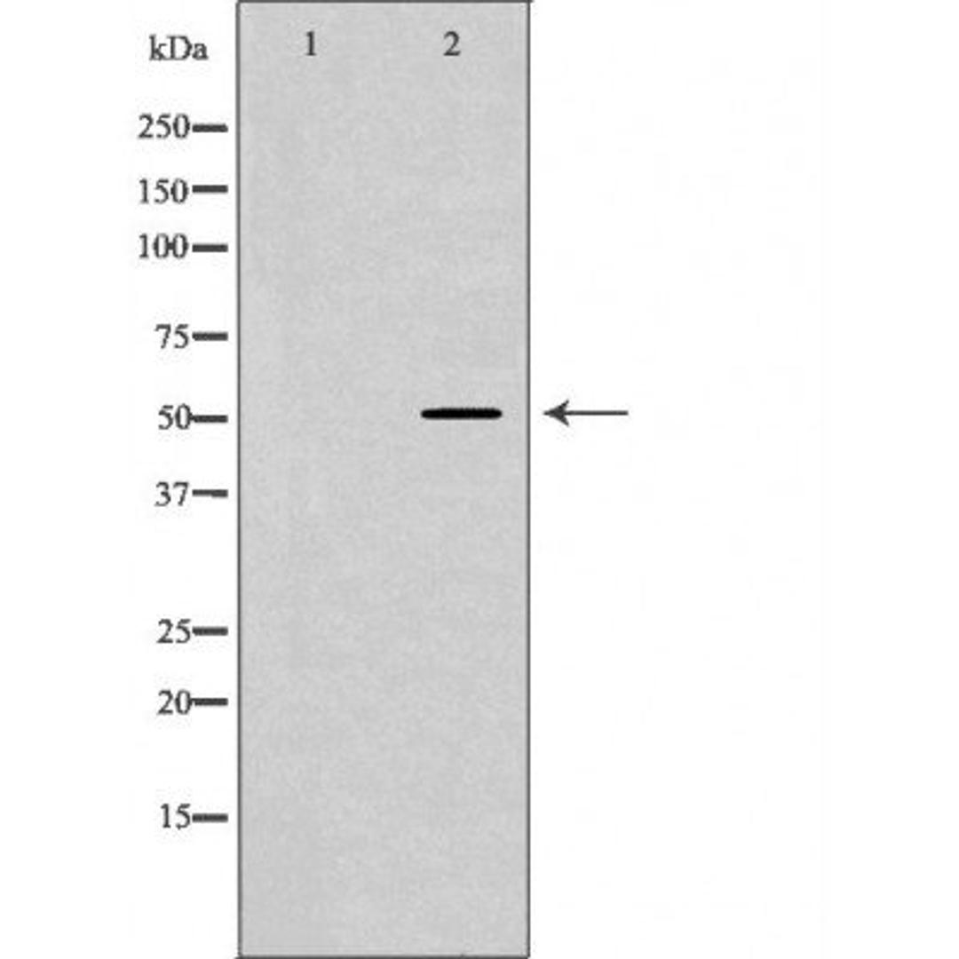 Western blot analysis of various cell lines using SEMG1 antibody