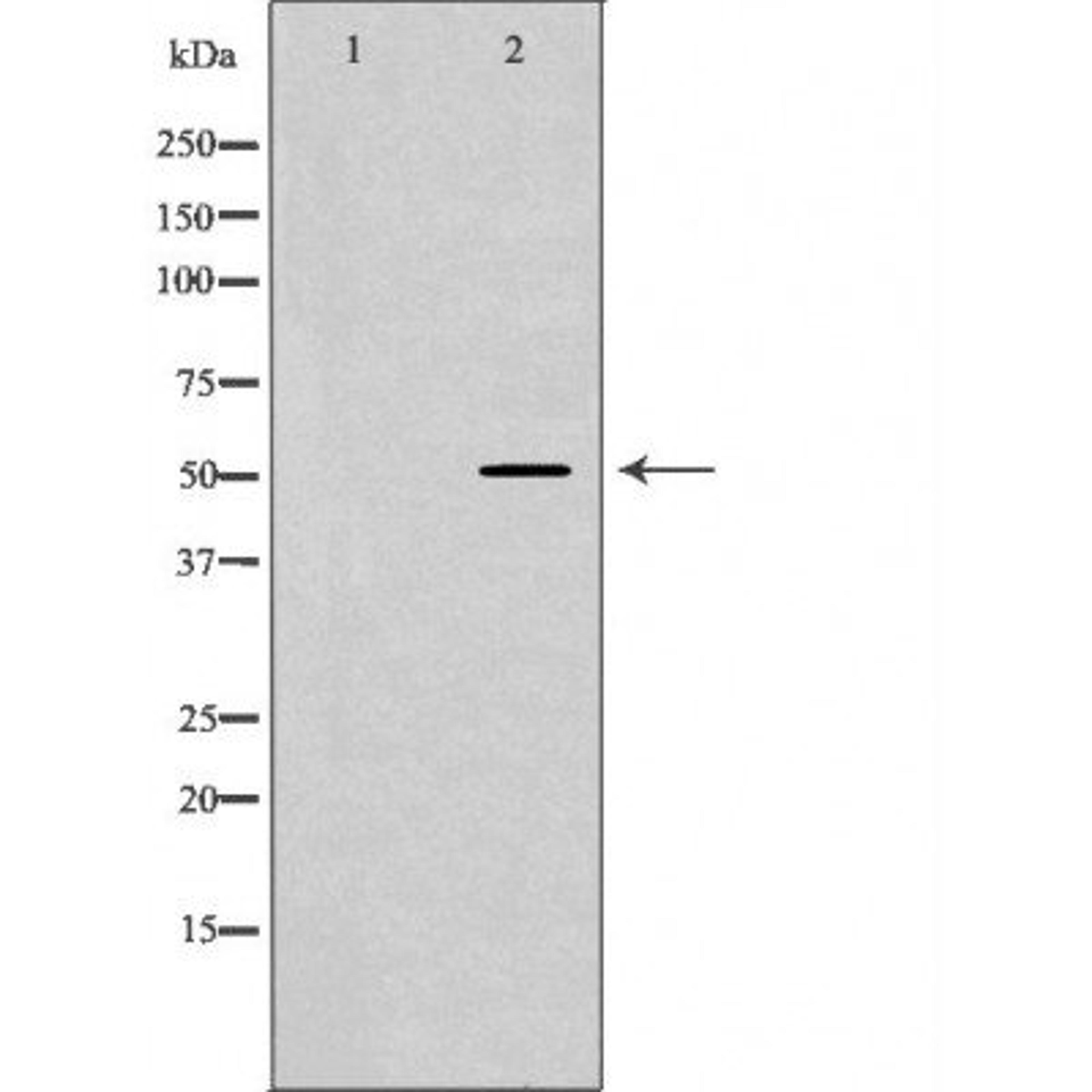 Western blot analysis of various cell lines using SEMG1 antibody