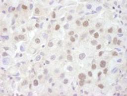 Detection of human REA by immunohistochemistry.