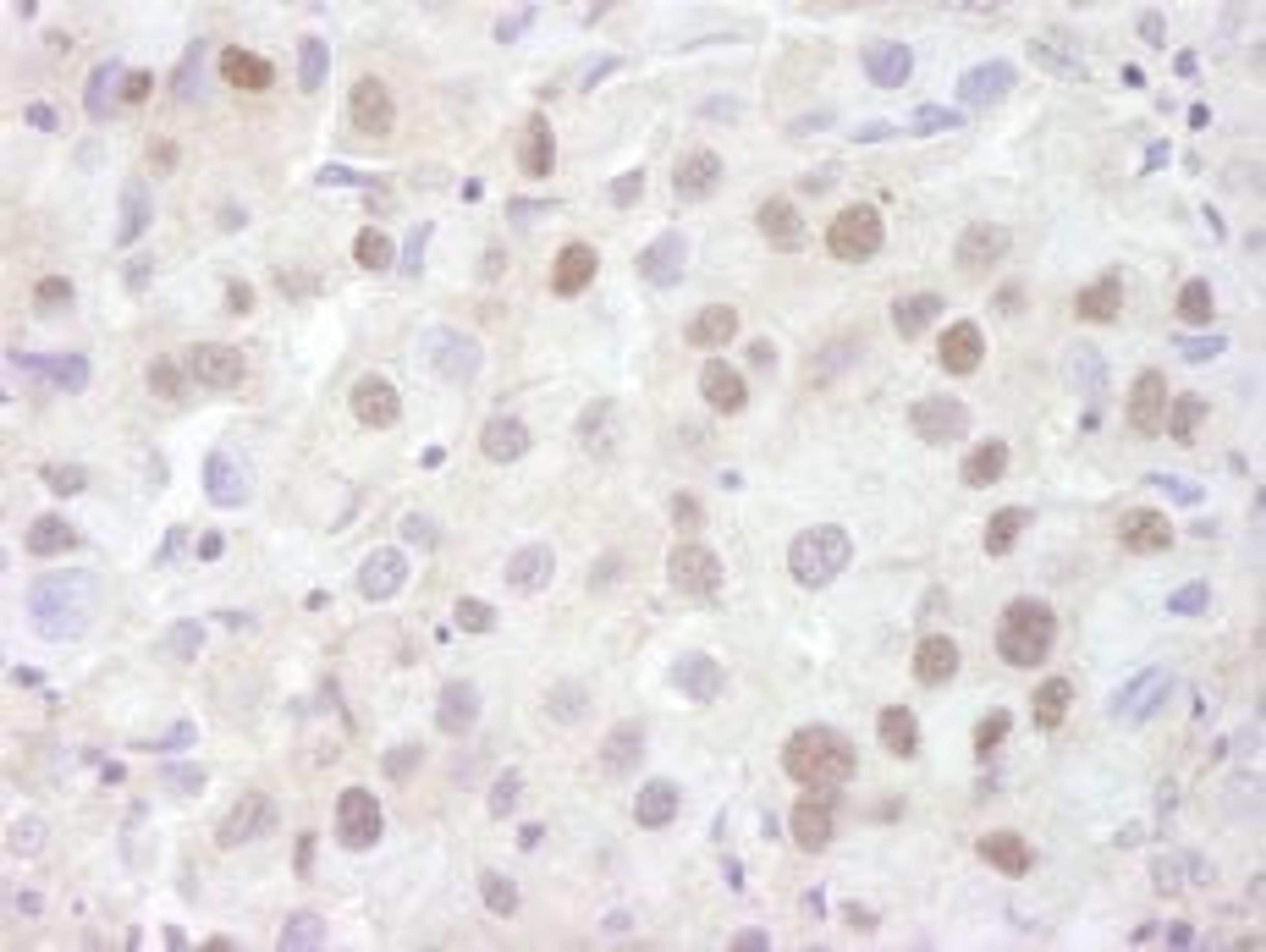 Detection of human REA by immunohistochemistry.