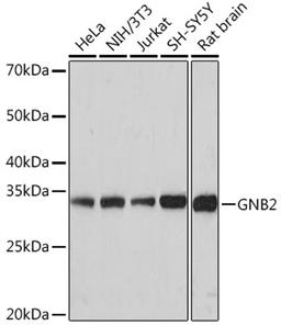 Western blot - GNB2 Rabbit mAb (A9643)