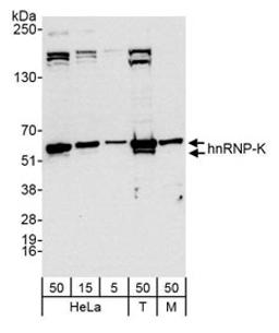 Detection of human and mouse hnRNP-K by western blot.