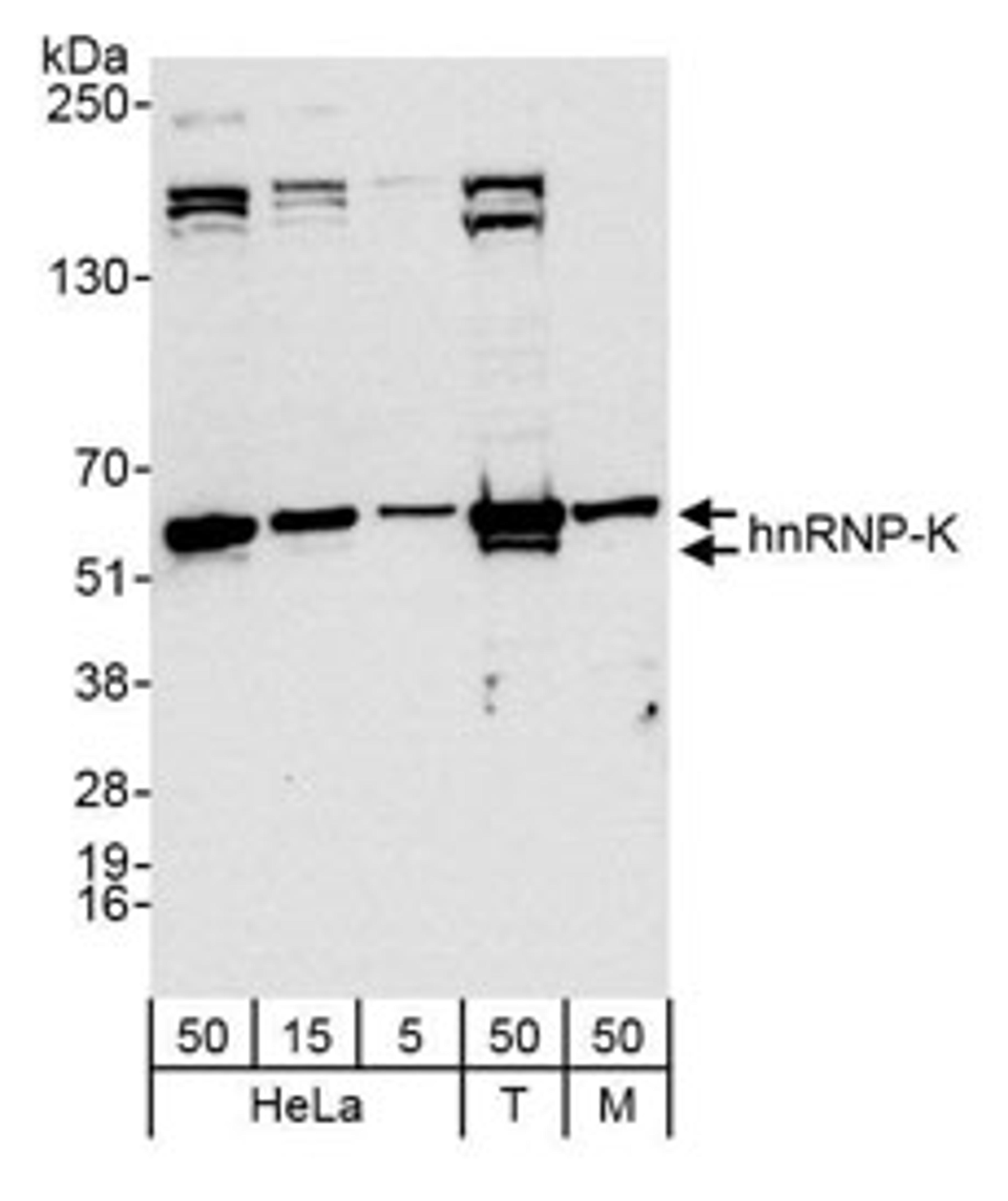 Detection of human and mouse hnRNP-K by western blot.