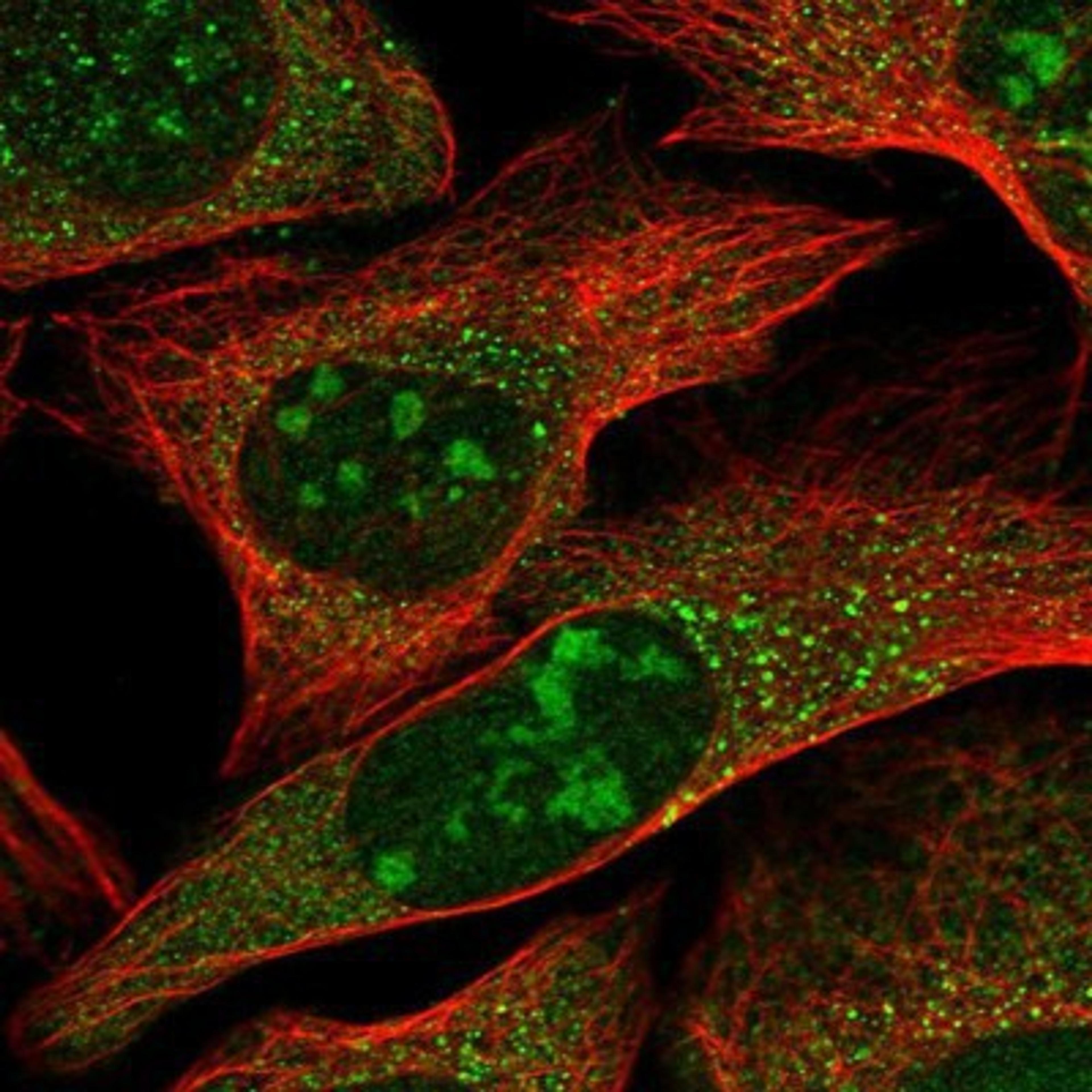 Immunocytochemistry/Immunofluorescence: GLTSCR2 Antibody [NBP1-80905] Staining of human cell line U-2 OS shows positivity in nucleoli & vesicles.