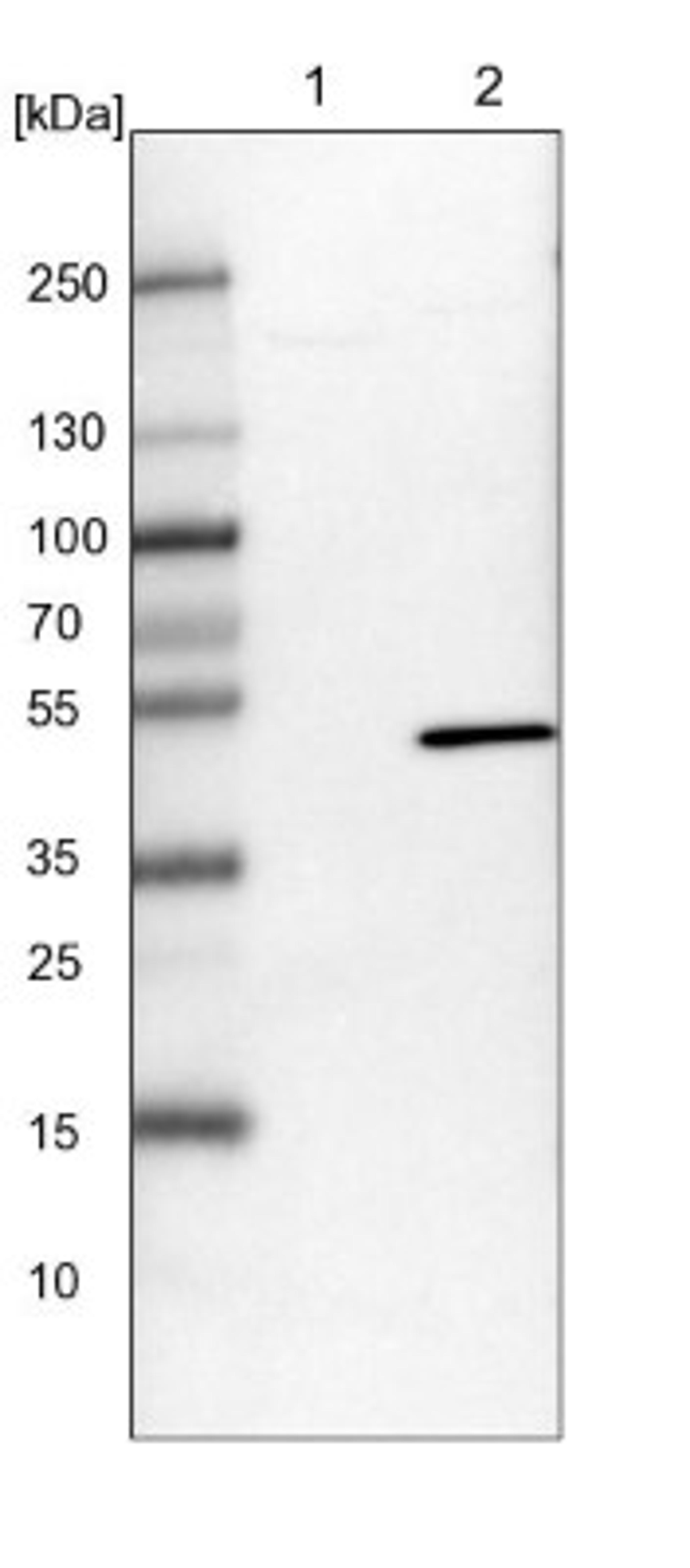 Western Blot: NMD3 Antibody [NBP1-84524] - Lane 1: NIH-3T3 cell lysate (Mouse embryonic fibroblast cells)<br/>Lane 2: NBT-II cell lysate (Rat Wistar bladder tumour cells)