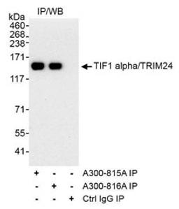 Detection of human TIF1 alpha/TRIM24 by western blot of immunoprecipitates.