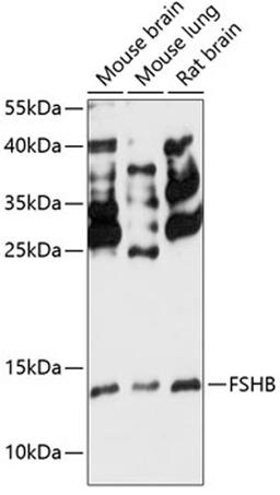 Western blot - FSHB antibody (A14532)