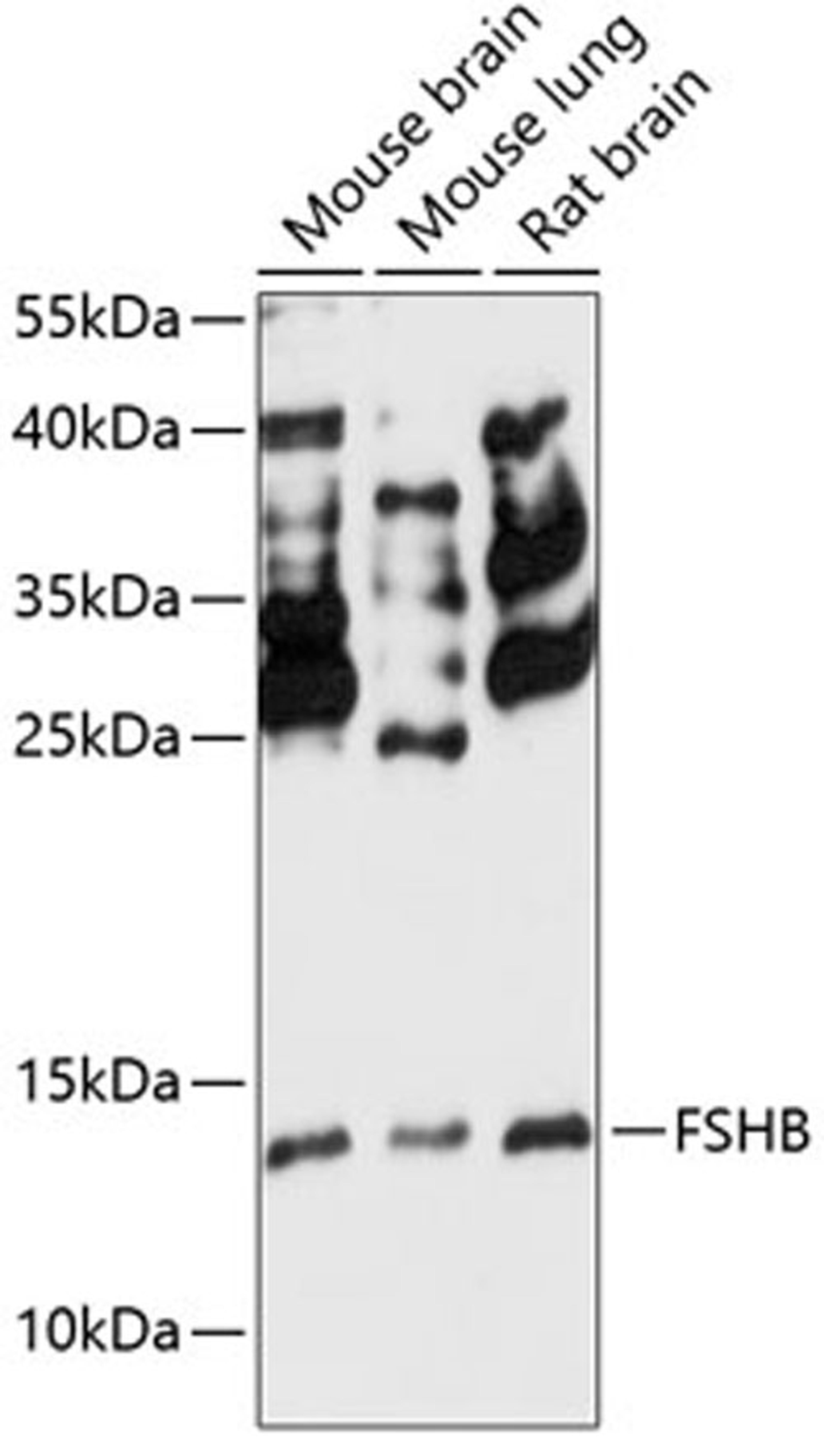 Western blot - FSHB antibody (A14532)