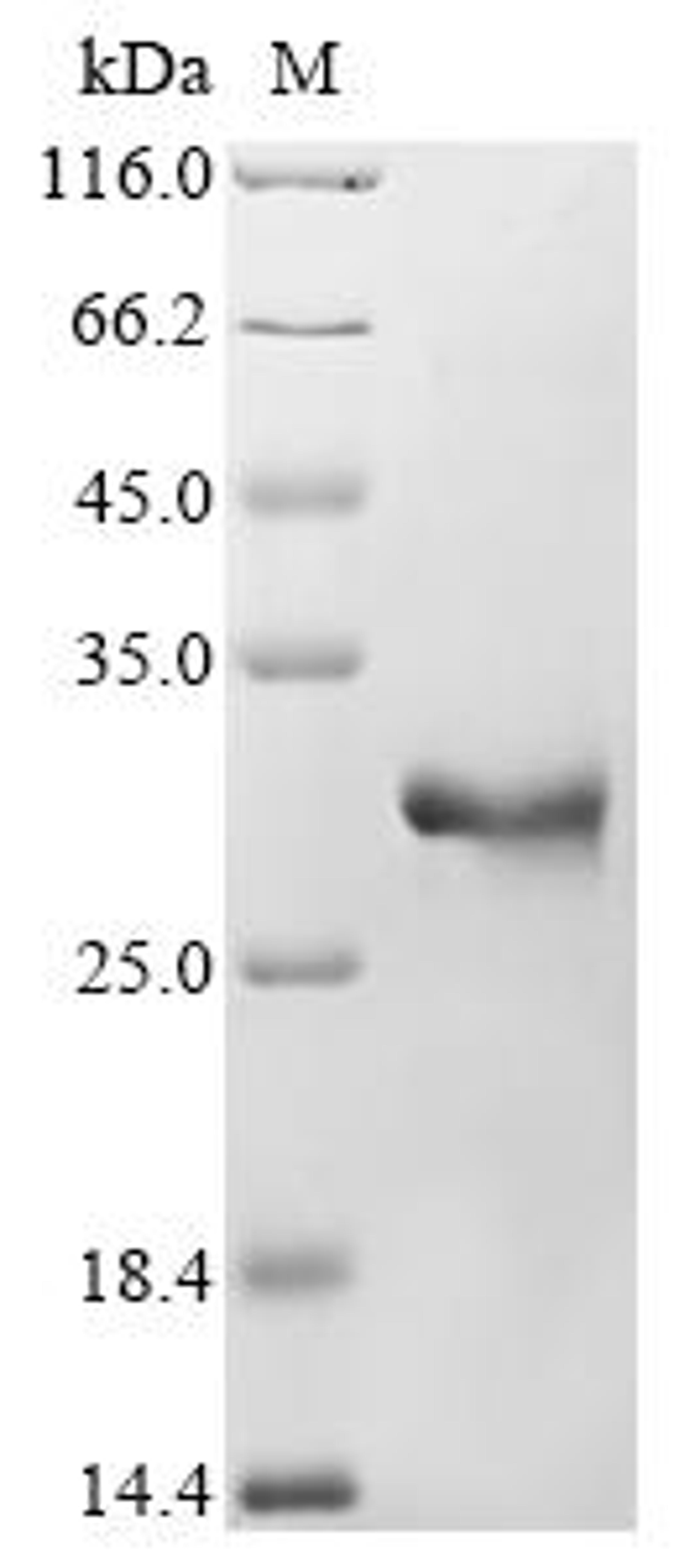(Tris-Glycine gel) Discontinuous SDS-PAGE (reduced) with 5% enrichment gel and 15% separation gel.